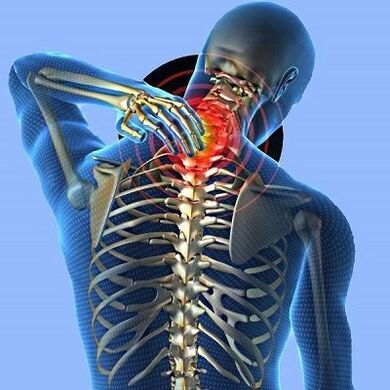 Жатыр мойны остеохондрозымен ауырсыну