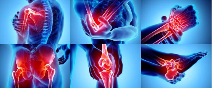 Қабынған буындар